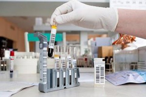 В Одессе от тяжелой пневмонии после перенесенной кори умер 10-месячный ребенок, передает корреспондент “ПолитНавигатора”....